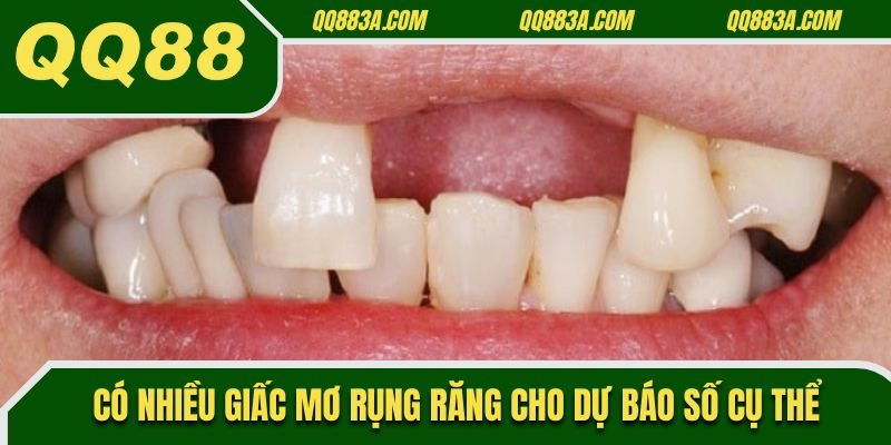 Có nhiều giấc mơ rụng răng cho dự báo số cụ thể